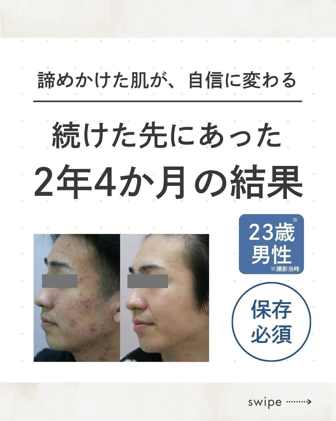 諦めかけてた肌が自信にかわる!